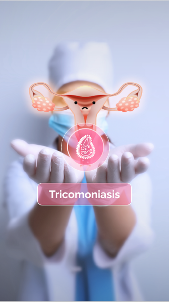 Tricomoniasis