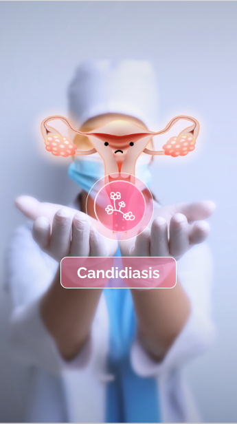 Candidiasis